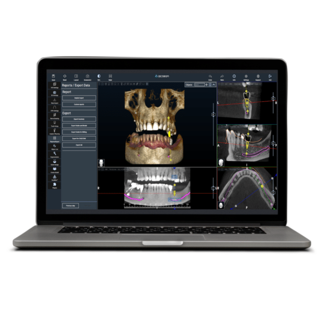 RealGUIDE 6.0
